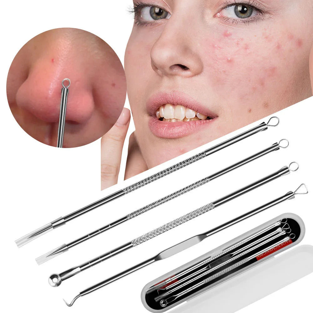 4pcs Acne Needle Set for Blackhead, Blemish, and Pimple Removal by Paradise Divas
