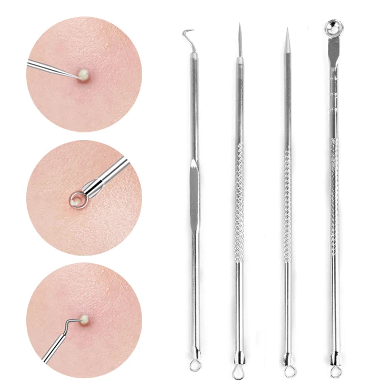 Paradise Divas 4pcs Acne Blackhead Removal Needles Set for Precision Skin Care 
