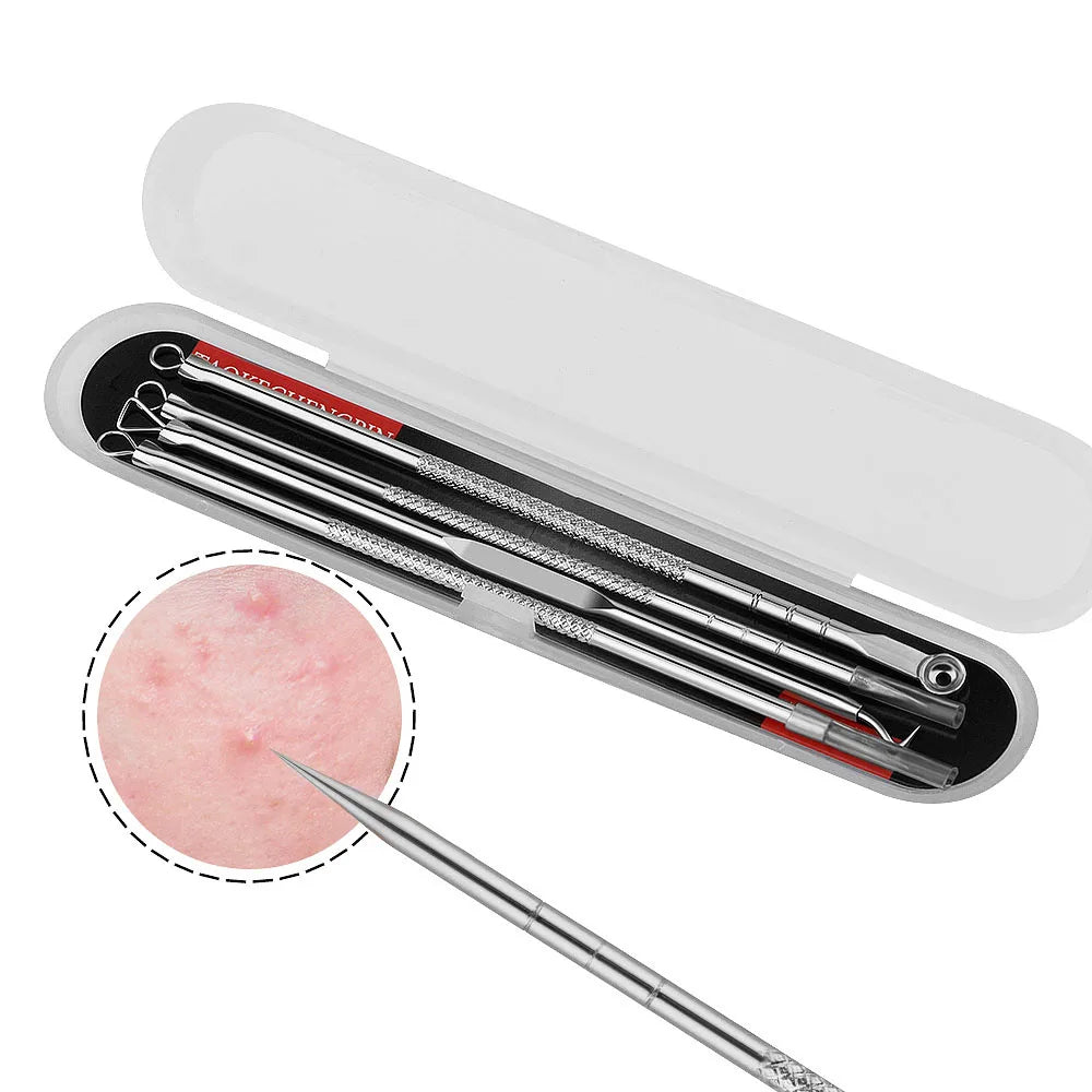 4pcs Acne Needle Set for Blackhead, Blemish, and Pimple Removal by Paradise Divas
