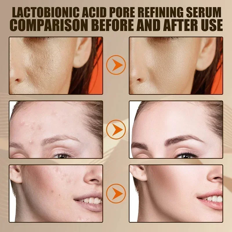 Lactobionic acid facial serum for a smooth and youthful complexion
