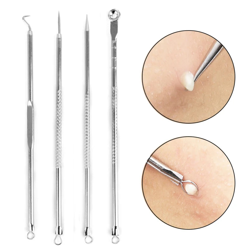 Paradise Divas 4pcs Acne Blackhead Removal Needles Set for Precision Skin Care 
