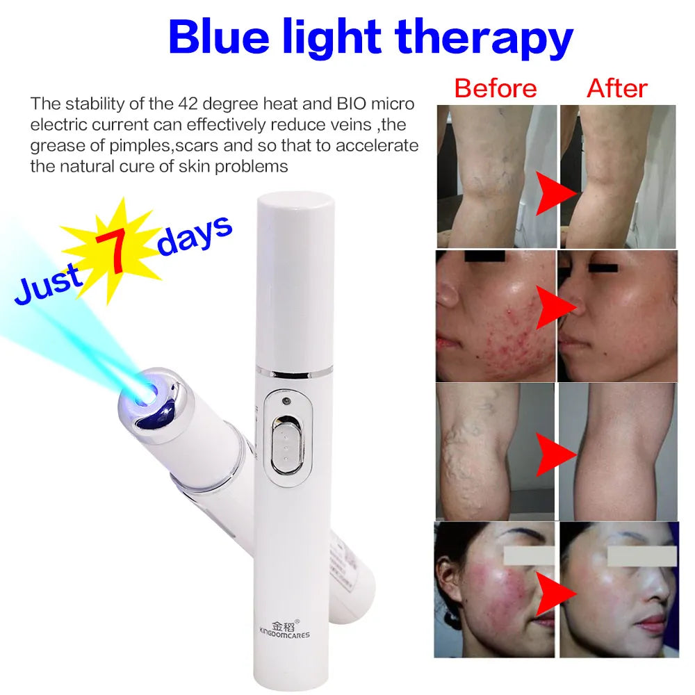 Paradise Divas Blue Light Facial Machine for Acne and Wrinkle Removal with Laser Pen
