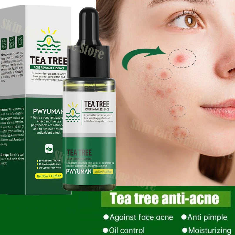 Paradise Divas tea tree acne removal serum for a clear, blemish-free complexion
