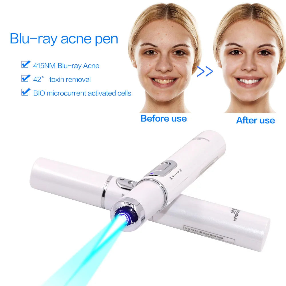 Paradise Divas Blue Light Facial Machine for Acne and Wrinkle Removal with Laser Pen
