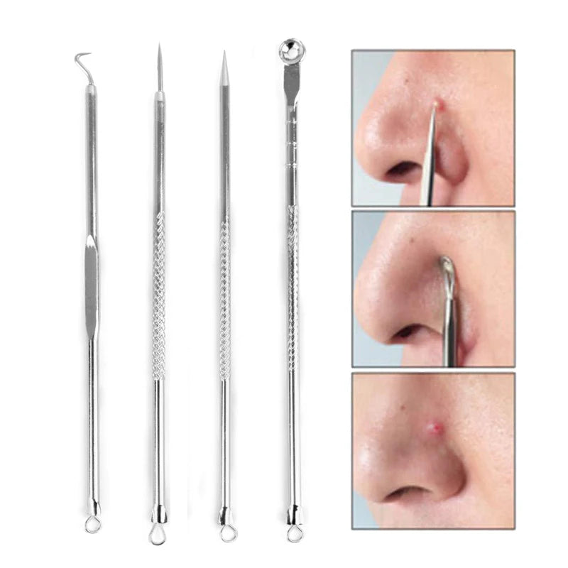 Paradise Divas 4pcs Acne Blackhead Removal Needles Set for Precision Skin Care 
