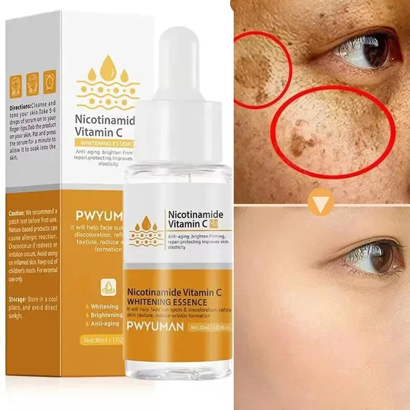 Vitamin C and nicotinamide serum to whiten and remove freckles and dark spots - Paradise Divas 
